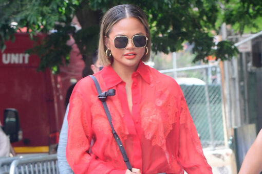 Chrissy Teigen says she had fat removed from her cheeks: ‘No shame in my game’