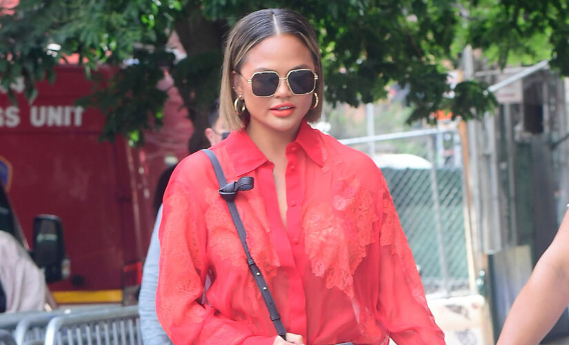 Chrissy Teigen says she had fat removed from her cheeks: ‘No shame in my game’