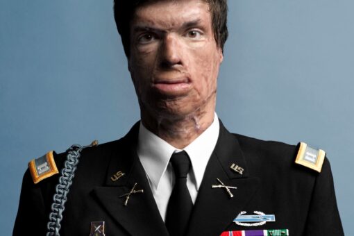 Sam Brown: I almost died serving in Afghanistan. Blinken needs to answer these 5 questions