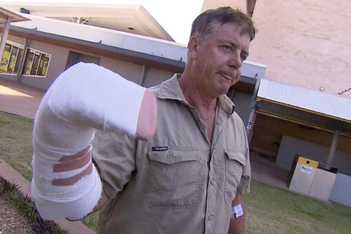 Australian man ‘a bit sore’ after hand was caught in croc’s jaws