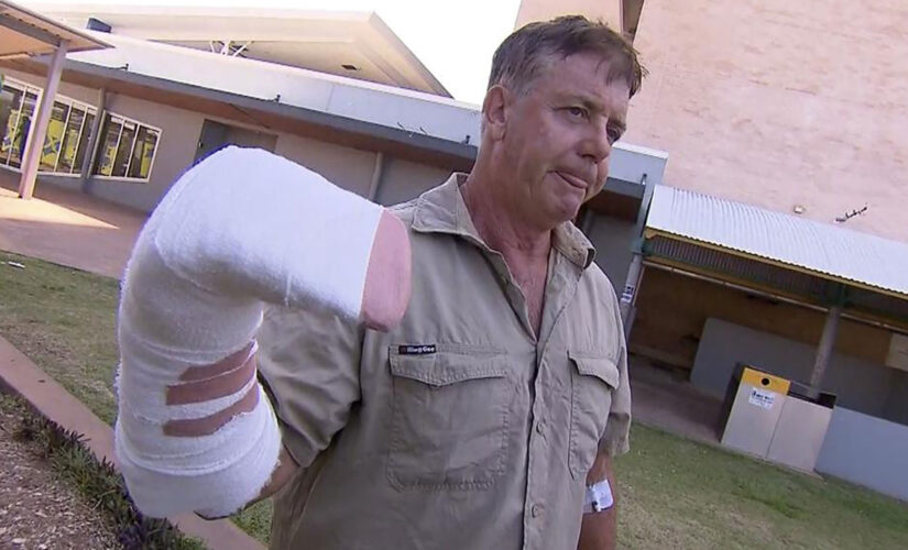 Australian man ‘a bit sore’ after hand was caught in croc’s jaws