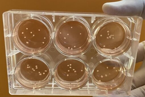 Lab-grown mini brains mimic Parkinson’s disease, researchers say
