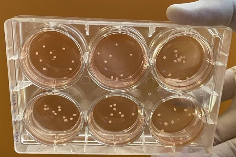 Lab-grown mini brains mimic Parkinson’s disease, researchers say