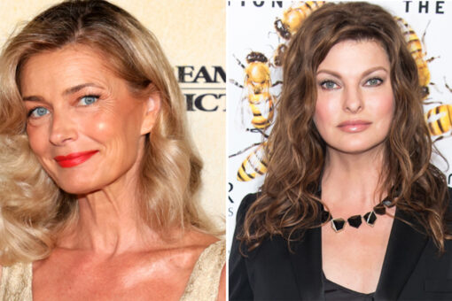 Paulina Porizkova pens supportive message to ‘permanently deformed’ model Linda Evangelista