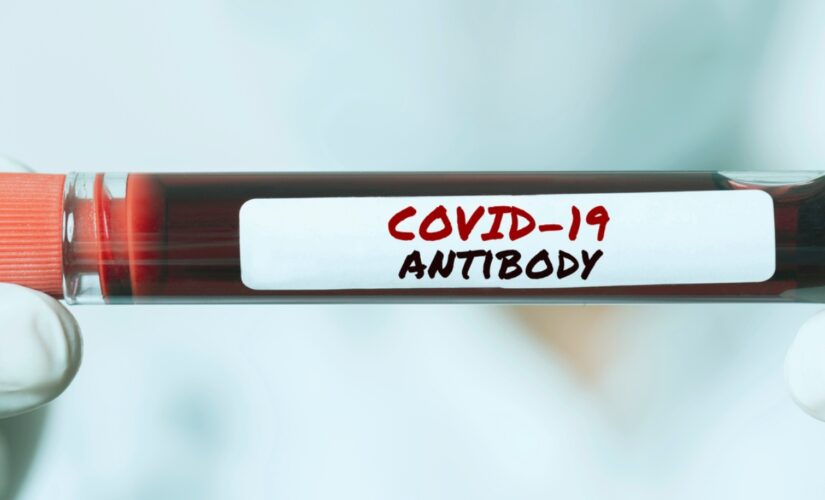 US government plans to purchase large supply of COVID-19 treatment sotrovimab for winter surge