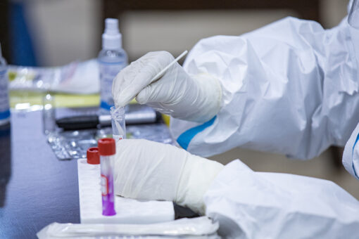 White House turned down plan in October to boost COVID testing: report