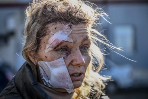 Russia-Ukraine crisis: Graphic photos show bloodied civilians amid invasion