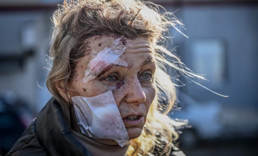 Russia-Ukraine crisis: Graphic photos show bloodied civilians amid invasion