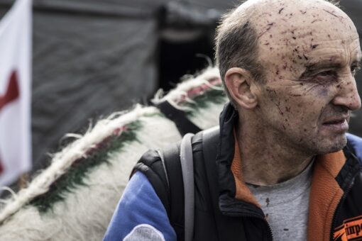 Russia-Ukraine war: Photos show Ukrainians traversing broken bridges to flee as those at home bury their dead