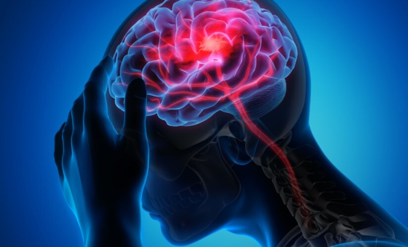 Stroke risk: What to know