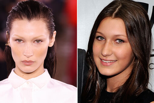 Yolanda Hadid faces backlash for allowing supermodel daughter Bella to get a nose job at age 14