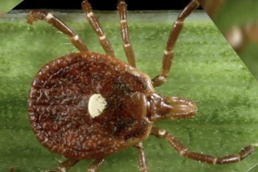 Single tick bite can cause a life-threatening meat allergy: report