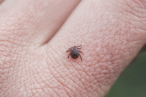 Tick bites on the rise: How to stay safe as you head outdoors