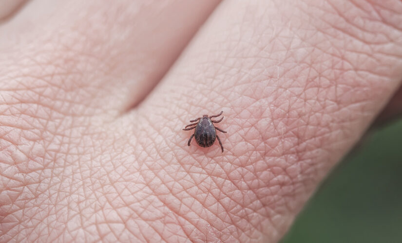 Tick bites on the rise: How to stay safe as you head outdoors