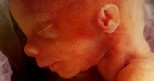 Over 63 million abortions have occurred in the US since Roe v. Wade decision in 1973