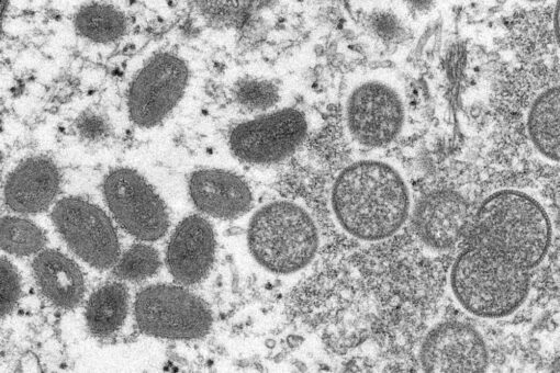 Monkeypox in the US: CDC reports 4 more cases