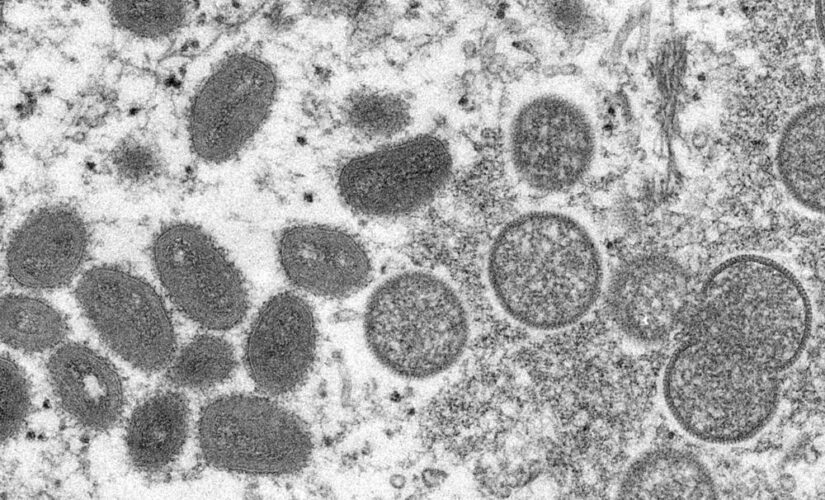 Monkeypox in the US: CDC reports 4 more cases