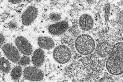 Hundreds of monkeypox cases reported worldwide: WHO
