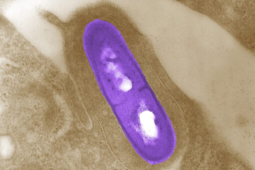 Listeria outbreak may be linked to Florida, CDC says