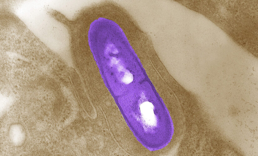 Listeria outbreak may be linked to Florida, CDC says