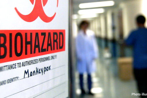 UK: Monkeypox cases rise to 1,735 with most cases in London