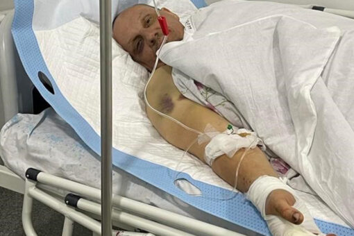 Ukraine war victim brutalized by Russian military recovering months later