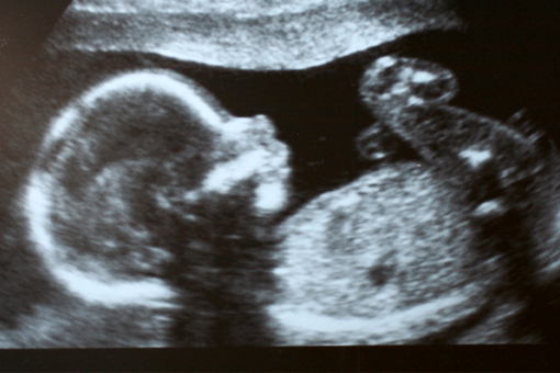House resolution celebrating Roe v. Wade ruling would designate June ‘Month of Li fe’