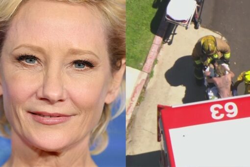 Anne Heche crashes car into a home igniting fire, taken away in ambulance with severe burns: report