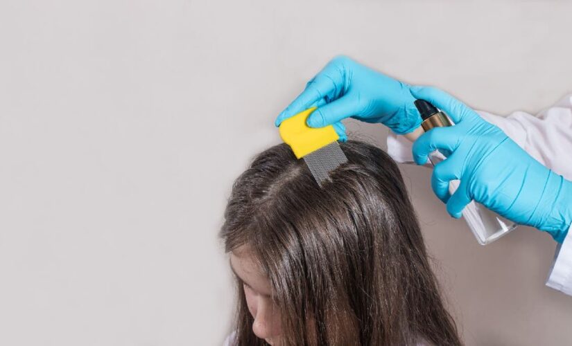 Kids with head lice don’t need to leave school: report