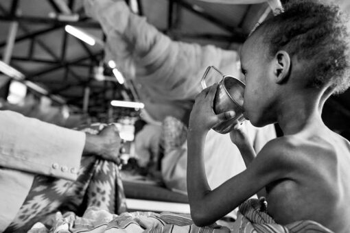 Half a million Somali children under 5 at risk of dying from famine