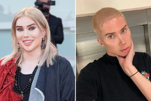 Influencer Oli London breaks down $300,000 cost of extensive surgeries to look like a Korean woman