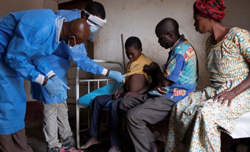 Widespread illness, deaths go unnoticed as monkeypox continues to spread in Africa