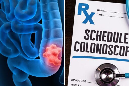 Health expert, citing ‘grave concern,’ says results of new colonoscopy study are ‘widely’ misinterpreted