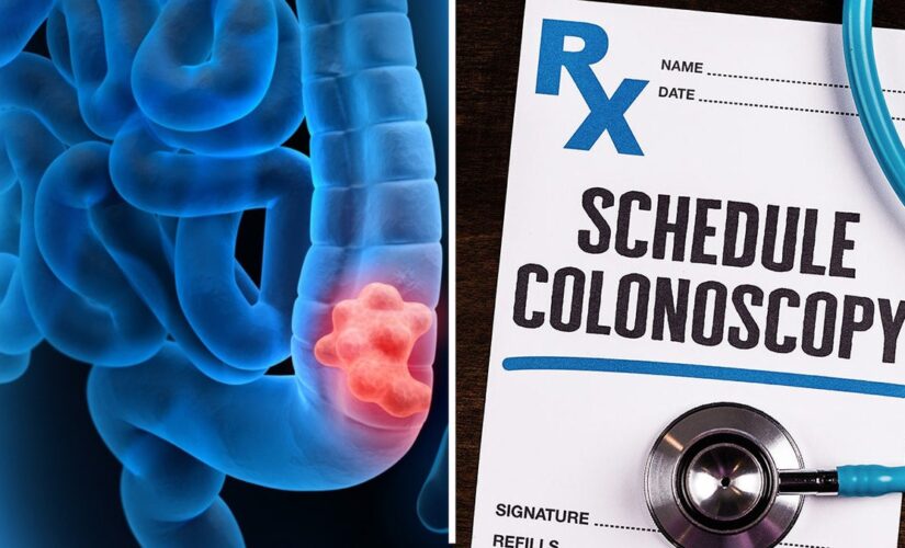 Health expert, citing ‘grave concern,’ says results of new colonoscopy study are ‘widely’ misinterpreted