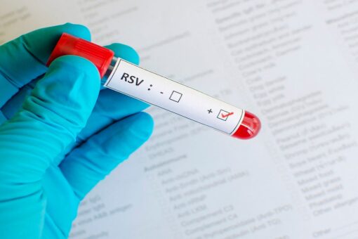 RSV surge raises questions about repeat cases: Can you or child get it again?