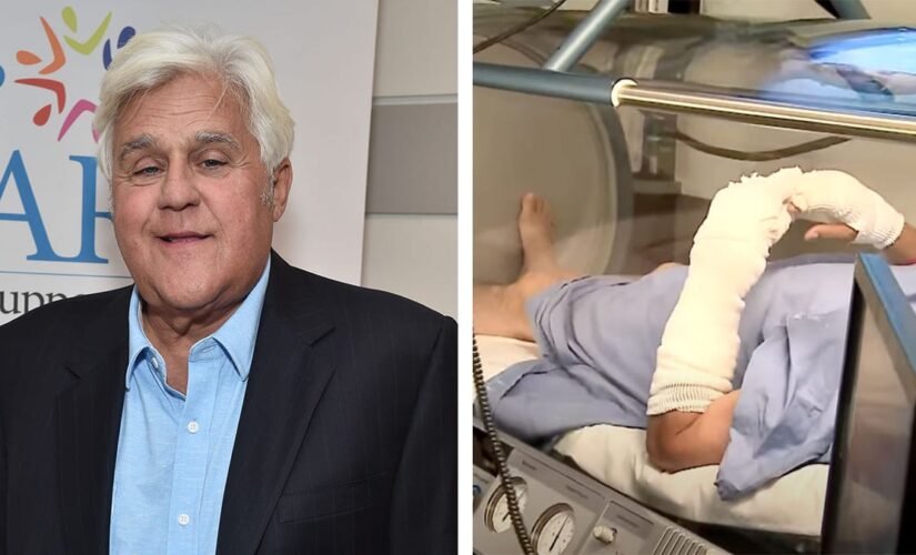 Jay Leno receives hyperbaric chamber treatment after he suffered ‘serious burns’ in gasoline fire