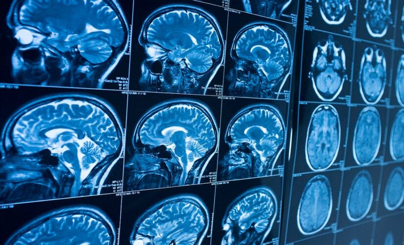 Teenage brains aged faster during the pandemic from stress, anxiety: study