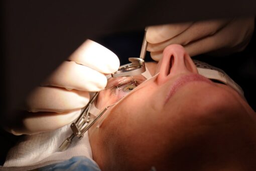 FDA warns that LASIK surgery patients need to be better informed of risks before eye procedure