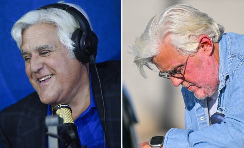 Jay Leno wants to joke about his facial burns: ‘There’s nothing worse than whiny celebrities’