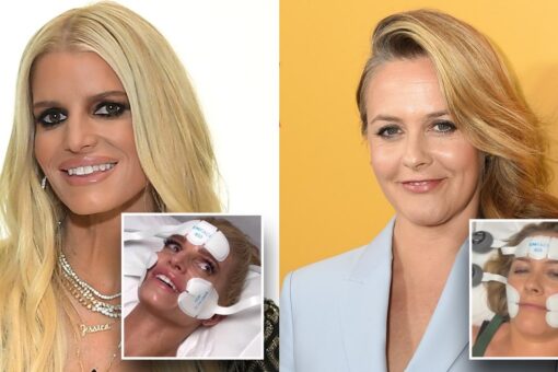 Jessica Simpson, Alicia Silverstone lead Hollywood stars pursuing fountain of youth via nonsurgical procedures