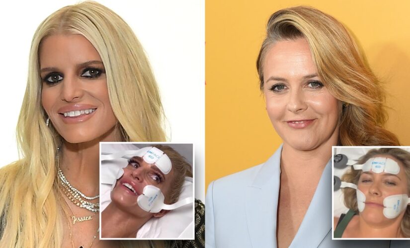 Jessica Simpson, Alicia Silverstone lead Hollywood stars pursuing fountain of youth via nonsurgical procedures