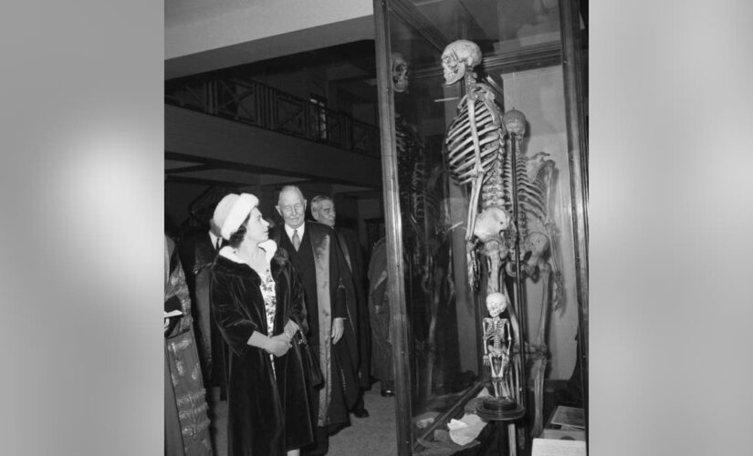 London’s ‘Irish Giant’: Museum wants to remove controversial skeleton display